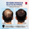 thumbnail image 3 of (2 pack) Taro Minoxidil Topical Aerosol Foam, 5%, Hair Regrowth Treatment for Men, 2.11 oz, 3 of 9