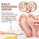 thumbnail image 4 of 1-3pcs Nail Repair Essence Remove Onychomycosis Serum Fungal Treatment Repair Ingrown And Thickened Grey Nails, 4 of 5