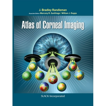 UPC: 9781630916473 | Atlas of Corneal Imaging (Hardcover)