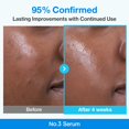 thumbnail image 4 of Sérum Numbuzin No.3 Blue Bio-Retinol Refinador de Poros, 30 ml, 4 of 9