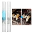 thumbnail image 3 of Pet Teeth Cleaning Pen, Anti Slip Design Soften And Remove  Calculus Pet Friendly Pet Teeth Whitening Toothbrush  For Cats For Dogs, 3 of 8