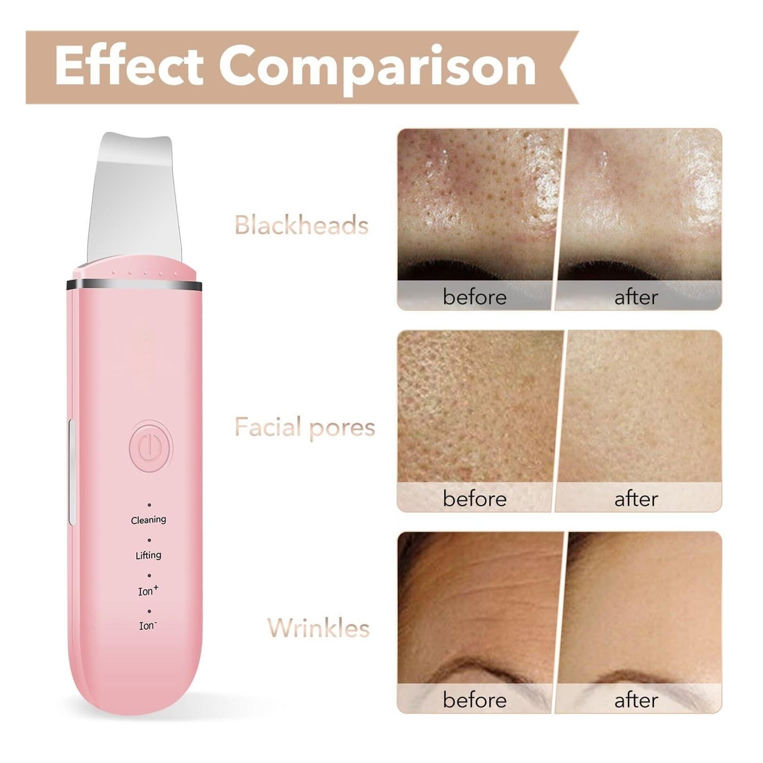 Skin Scrubber Face Skin Spatula Facial Scrubber Spatula for Deep Cleansing Blackhead Remover Pore Cleaner with 4 Modes (White)