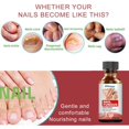 thumbnail image 4 of Aceite para el cuidado de las uñas,CAIXIN solución de tratamiento de uñas 30ml detiene las infecciones por hongos en las uñas para hombres y mujeres, 4 of 6