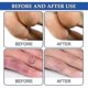 thumbnail image 5 of 1/2/3Pcs 30g Chilblain Cream Anti-cracking Frostbite Moisturiser Deep Nourishing, 5 of 5