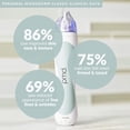 thumbnail image 3 of Kit de microdermoabrasión PMD Beauty Microderm Classic para rostro, 3 of 9