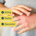 thumbnail image 5 of Tender Gentle 1% Hydrocortisone Cream Maximum Strength - 1 oz - Anti Itch Cream, Clean Ingridients, - For Eczema, and More, 5 of 6