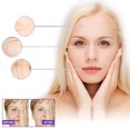 thumbnail image 4 of EELHOE Face Anti-Wrinkle Patch Skincare Pads Anti-envejecimiento Lifting Shaping Reafirmante EELHOE parche antiarrugas, 4 of 7