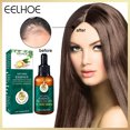 thumbnail image 3 of Esencia de Jengibre FLhrweasw Suero para Crecimiento y Reparación del Cabello, 3 of 7