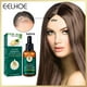 thumbnail image 3 of Esencia de jengibre aceite para el crecimiento del cabello suero hidratante Ndcxsfigh reparación del cabello seco dañado, 3 of 9