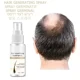 thumbnail image 4 of Spray para el crecimiento del cabello, suero para el crecimiento de raíces del cabello, previene la calvicie, cuidado contra la pérdida de pelos, aceite para el crecimiento del cabello, más grueso y r, 4 of 5