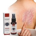 thumbnail image 1 of Spray para aliviar la psoriasis hidratante calmante 2 unidades de spray para aliviar la psoriasis suave para la hinchazón ANGGREK Otros, 1 of 8