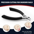 thumbnail image 2 of Toenail Clippers for Ingrown Toenail, Straight Nail Clippers for Ingrown Toenails, Professional Ingrown Toenail Treatment for Adults, Seniors, Men and Women (Black), 2 of 4