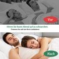 thumbnail image 3 of Premium Anti Snore Nose Clip Magnetized Breathing Enhancer for Improved Sleep and Airflow, 3 of 5