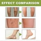 thumbnail image 4 of 50g Anti-Varicose Soothing Cream Relieve Soothing Swelling Pain Leg Cream for Women Men, 4 of 5