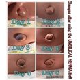 thumbnail image 4 of Umbilical Hernia Belt For Babies, Medical Child Belly Band Infant Abdominal Binder, Newborn Baby Hernia Support Truss Kids Navel Belly Button Band - S, 4 of 5