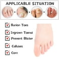 thumbnail image 5 of sixwipe 20 Pcs Gel Big Toe Caps, Gel Big Toe Protectors, Breathable Toe Protectors, Silicone Toe Covers for Big Toe, Blisters, Corns, Hammer Toes, Friction Pain Relief(Beige), 5 of 7