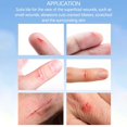 thumbnail image 5 of Liquid Bandage Waterproof Liquid Skin Protectant Home Skin Gels 5ml, 5 of 5