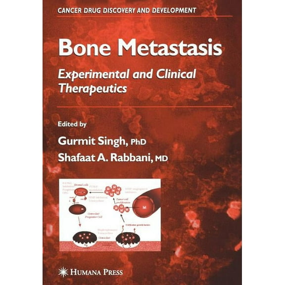 Cancer Drug Discovery & Development Bone Metastasis, (Paperback)