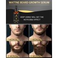thumbnail image 4 of Beard Growth Kit, Derma Roller for Beard Growth,Beard Roller for Hair Growth for Men,Stimulate Promote Beard Mustache and Hair Regrowth - Gifts for Men Him Dad Father Boyfriend, 4 of 6