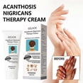 thumbnail image 2 of 1/2/3pcs Acanthosis Cream Nigrifix Cream For Acanthosis Nigricans Black Spot, 2 of 5