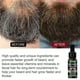 thumbnail image 2 of Beard Growth Oil Firming Moisturizing Spray Beard Care To Promo, 2 of 3