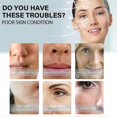 thumbnail image 4 of 120 piezas de hilo de colágeno de seda reafirmante facial antienvejecimiento arrugas rellenos faciales cosméticos cuidado de la piel 60 piezas / caja | 8031724903102, 4 of 5