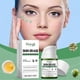 thumbnail image 2 of Instant Erase Cream, Dark Spot Remover Anti-Freckle Blemishes Cream for Face Body, Uneven Skin-Tone Serum for Daily Use, 2 of 5
