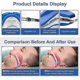 thumbnail image 5 of Anti-Snoring Mandibular Protrusion Splint with Adjustable Size and Medical Grade Material for Snoring Relief, 5 of 5