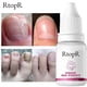 thumbnail image 5 of Rtopr Ginger Nail Treat Ment Nail Toe Repair 10ml, 5 of 5