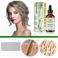 thumbnail image 2 of Pure Rosemary Essential Oil for Hair and Scalp Health, 100% Natural, Supports Growth, Relieves Dryness, 60ml, 2 of 5