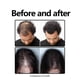 thumbnail image 5 of Hair Growth Serum Spray, Anti Shedding Hair Spray, Natural Hair Essence Spray, 5 of 5