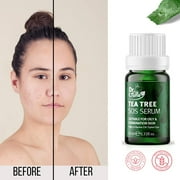Farmasi Dr. C. Tuna Tea Tree SOS Serum, Anti-Aging Face Moisturizer 10 ml./0.33 Fl. Oz