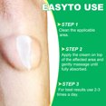 thumbnail image 3 of Crema De Eliminación De Lipoma Ungüento de celulitis de lipólisis ligero 20g de yeso antitumoral para moldear el cuerpo, 3 of 9