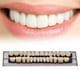 thumbnail image 5 of Prótesis dental: dientes de resina sintética, 140 unidades, color MIBICIRI A2, 5 of 6