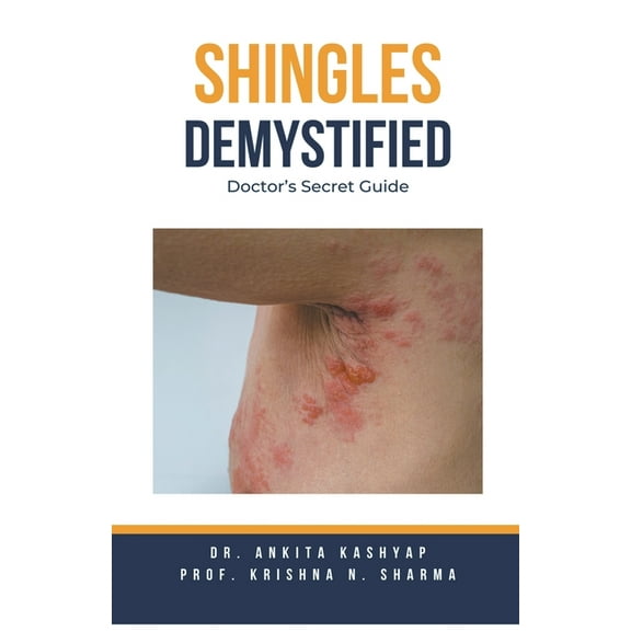 Shingles Demystified: Doctor's Secret Guide, (Paperback)