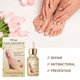 thumbnail image 1 of Líquido Para El Cuidado De Las Uñas Líquido de eliminación de solución de reparación de uñas gris antiinfeccioso de esencia de cuidado de reparación de pies Ndcxsfigh Cuidado Belleza, 1 of 3