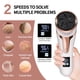 thumbnail image 3 of Máquina de pedicura eléctrica, cuidado profesional de los pies, Lima para talones, elimina la piel muerta, removedor de callos, máquina para el cuidado de los pies, papel de lija, 3 of 4