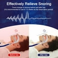 thumbnail image 4 of Anti Snoring Devices - Snoring Solution - Mini Sleep Apnea Devices - Upgraded Variable Speed Mini Anti Snoring - Suitable for All Nose Shapes - Sleep with Mouth Closed - White, 4 of 7