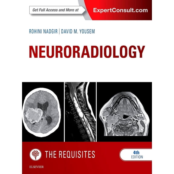 Neuroradiology: The Requisites