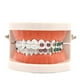 thumbnail image 1 of 1pc Dental Orthodontic Typodont With Ortho Metal Ceramic Bracket Arch Wire Orthodontic Toothed Denture, 1 of 4