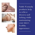 Noble Formula Pyrithione Zinc (ZnP) .25 Maximum Strength Cream, 4 oz