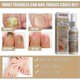thumbnail image 3 of Spray reparador de uñas grises Elimina las uñas grises Tratamiento para uñas Tratamiento nutritivo para uñas Bright Nail | 8042665686184, 3 of 5