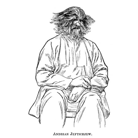 Dog-Faced Man, 1874. /Nandrian Jeftichjew, Father Of Fedor Jeftichjew ...