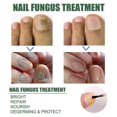 thumbnail image 3 of Extra Strong Nail Fungus Treatment, Best Nail Repair Stop Fungal Growth Effectiv, 3 of 5
