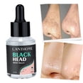 thumbnail image 4 of Suero de Eliminación de Puntos Negros de 30 Ml, Control de Aceite, Hidratante para Acné, Hombres Y Mujeres, 4 of 9