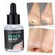 thumbnail image 4 of Suero para Eliminar Puntos Negros de 30 Ml, Control de Aceite para Limpieza Profunda de , atención de, 4 of 9