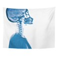 thumbnail image 1 of UFAEZU Neurosurgery X Ray Skull and Stroke Cerebrovascular Accident Cva Wall Art Hanging Tapestry Home Decor for Living Room Bedroom Dorm 60x80 inch, 1 of 2