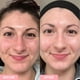 thumbnail image 5 of Tónico Facial Sand & Sky Marshmallow con Niacinamida 150 ml, 5 of 7