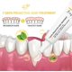 thumbnail image 3 of Gum Regrowth Essence 7 Gum Serum Gum Therapy Gel Gum Restore Gum, 3 of 5