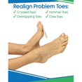 thumbnail image 4 of Toe Splint [Pair] - Hammer Toe Straightener - Joint Realign Cushion Brace for Claw, Curled, Crooked Toe - Metatarsal Support Loop Guard Alignment Corrector Wrap for Tendon, Broken Toe Surgery, 4 of 4